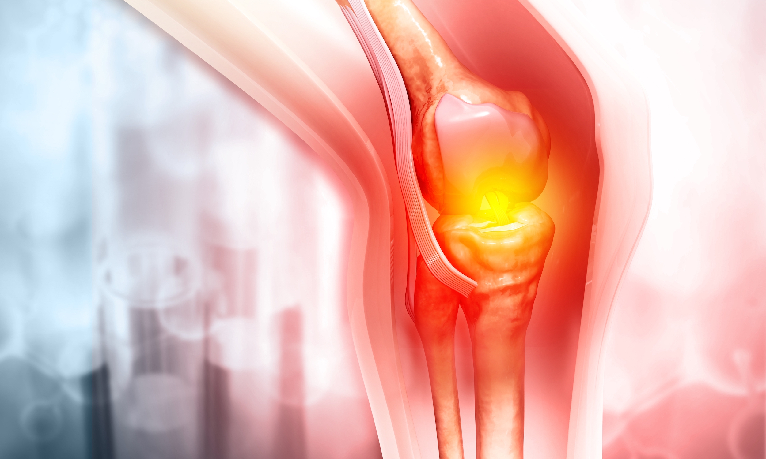 Robotic Assisted Knee Replacement Enhanced Precision Faster Recovery Robotic Assisted Knee Replacement Enhanced Precision Faster Recovery